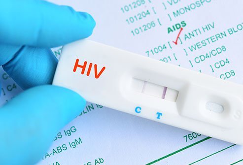 Permohonan Temujanji Online Saringan HIV 2021